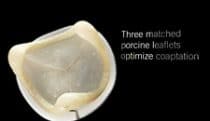 Tissue valve durability