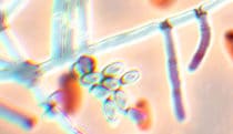 Fungal infection